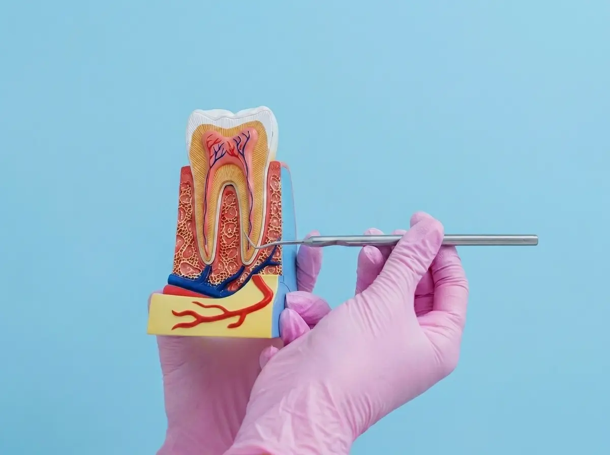 Root Canal Therapy
